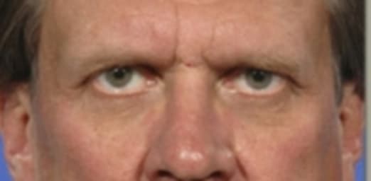 Before β Age 53